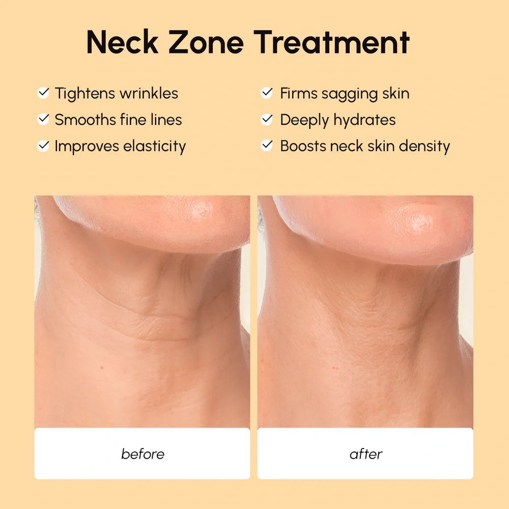 Lifting Neck Wrinkle Patches — image 3