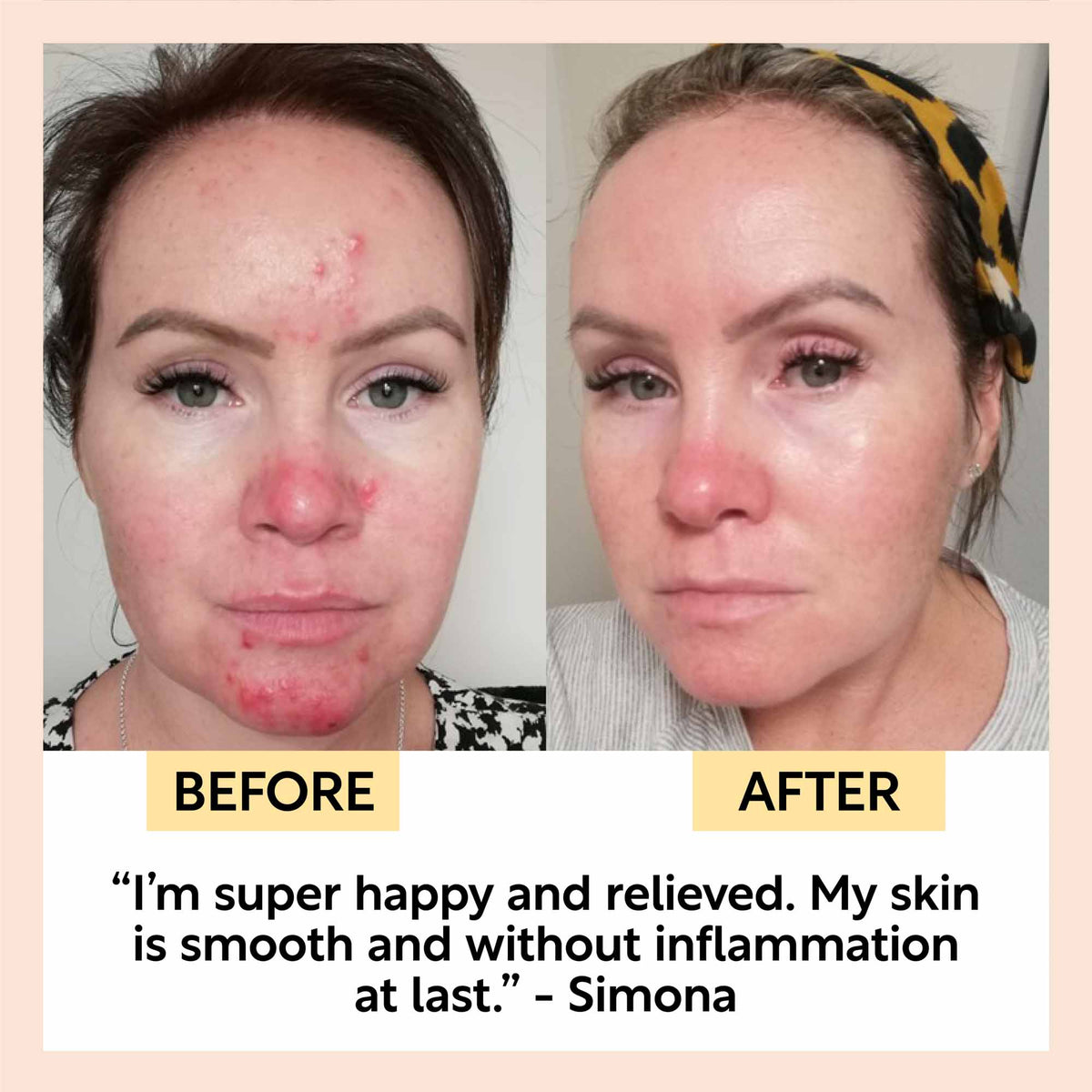Night Cream with Hyaluronic Acid + Niacinamide — image 9