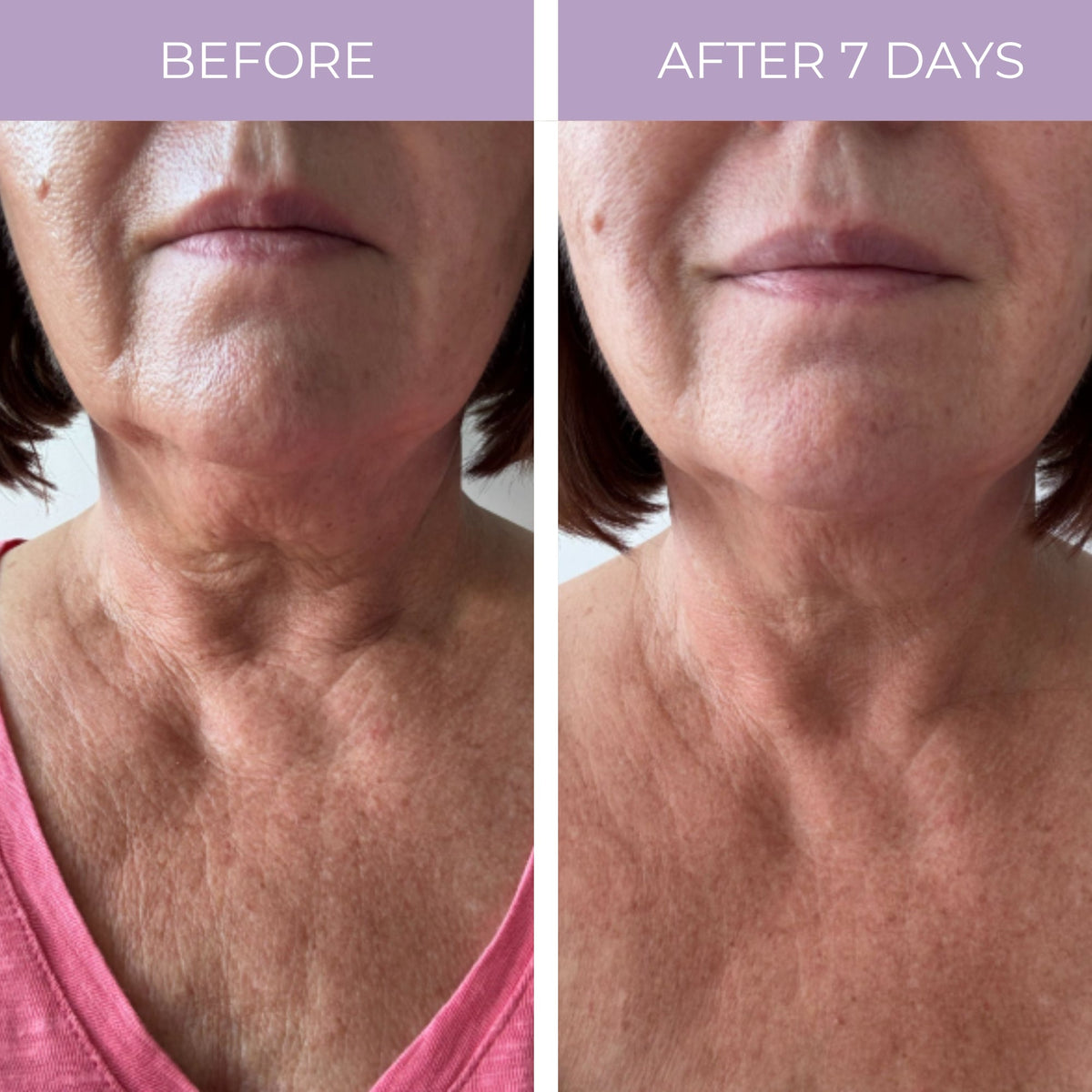 Ageless Throat & Decolletage Anti-Aging Neck Creme by PRAI Beauty — image 4 of 10