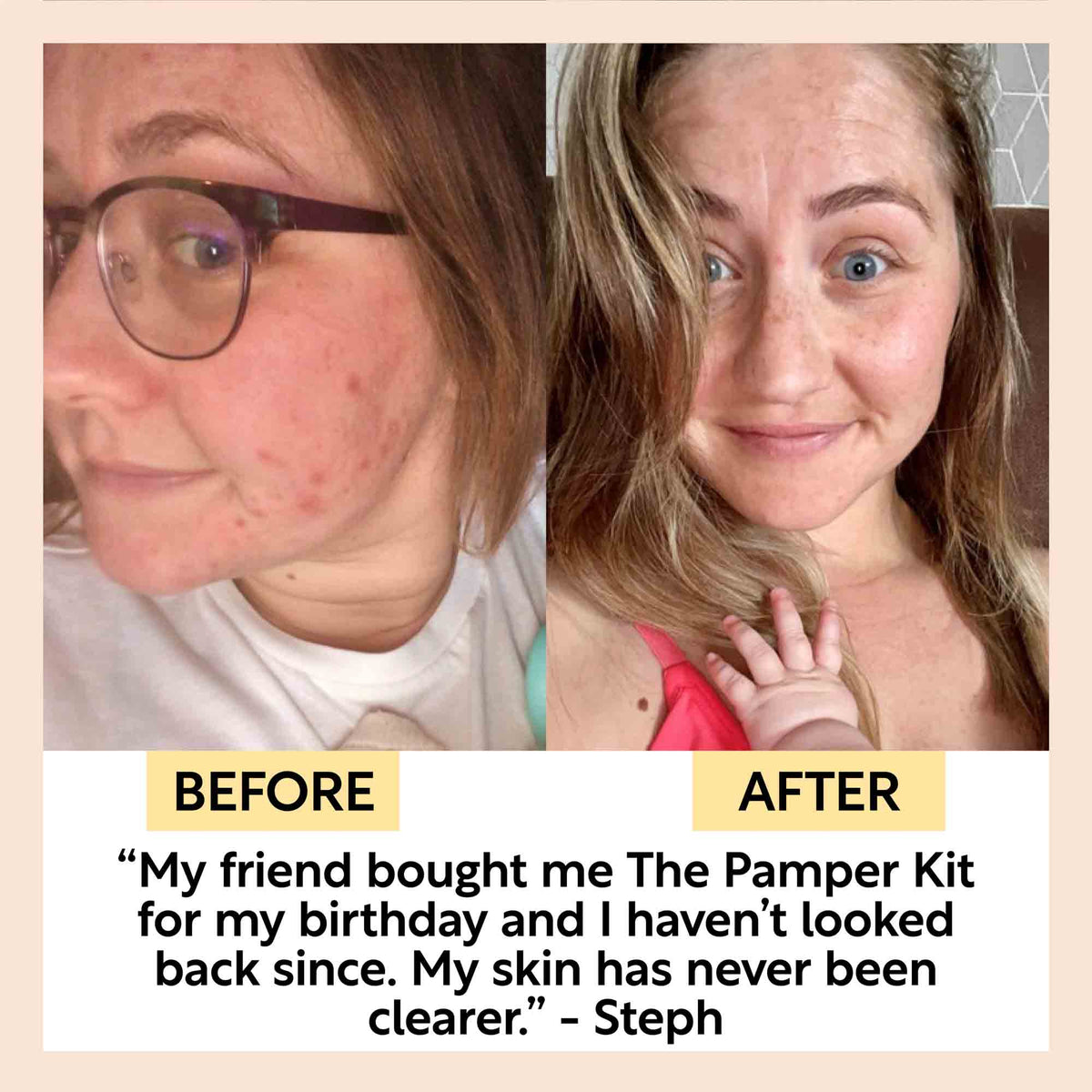 "Pamper + Gift" Skincare Kit — image 4