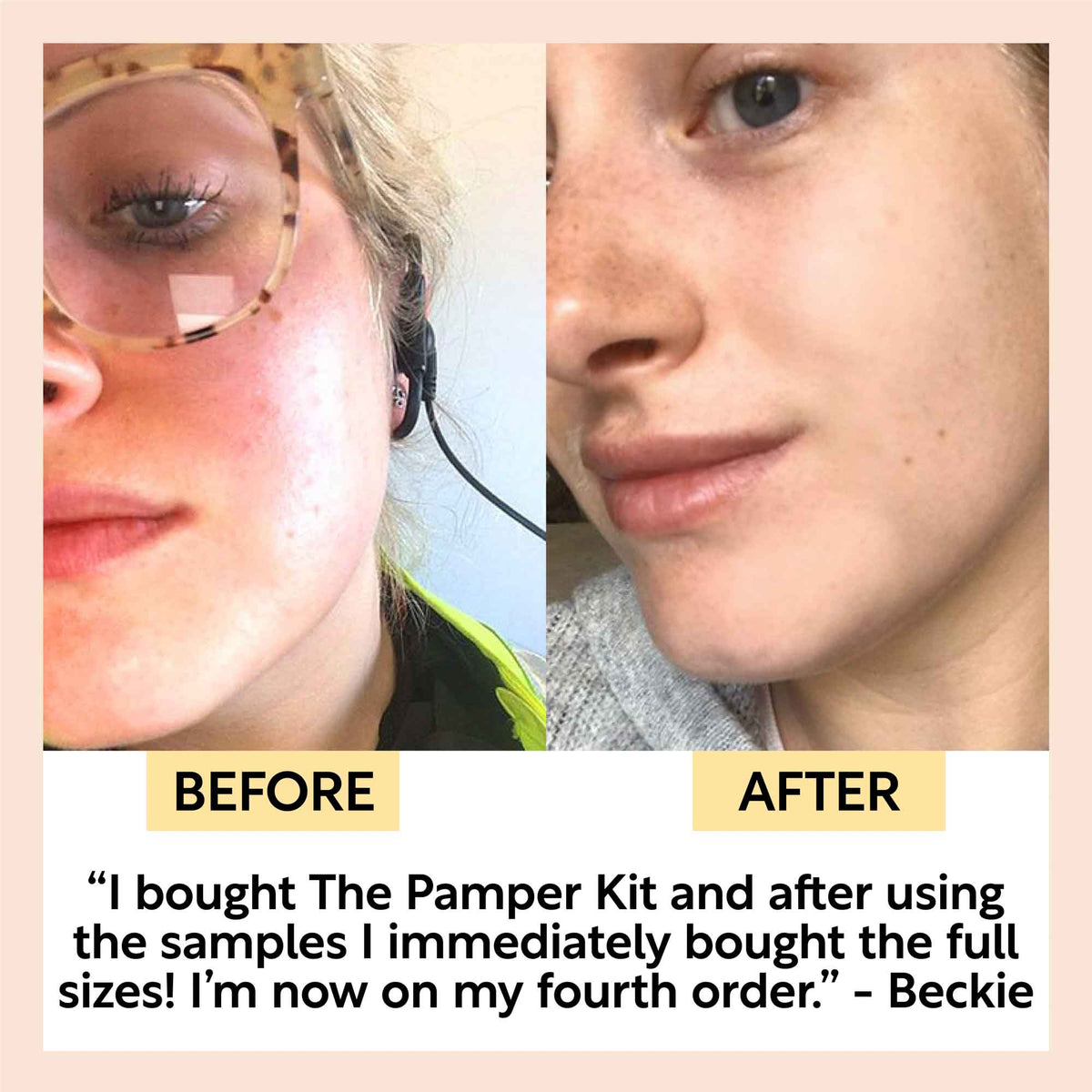 "Pamper + Gift" Skincare Kit — image 6