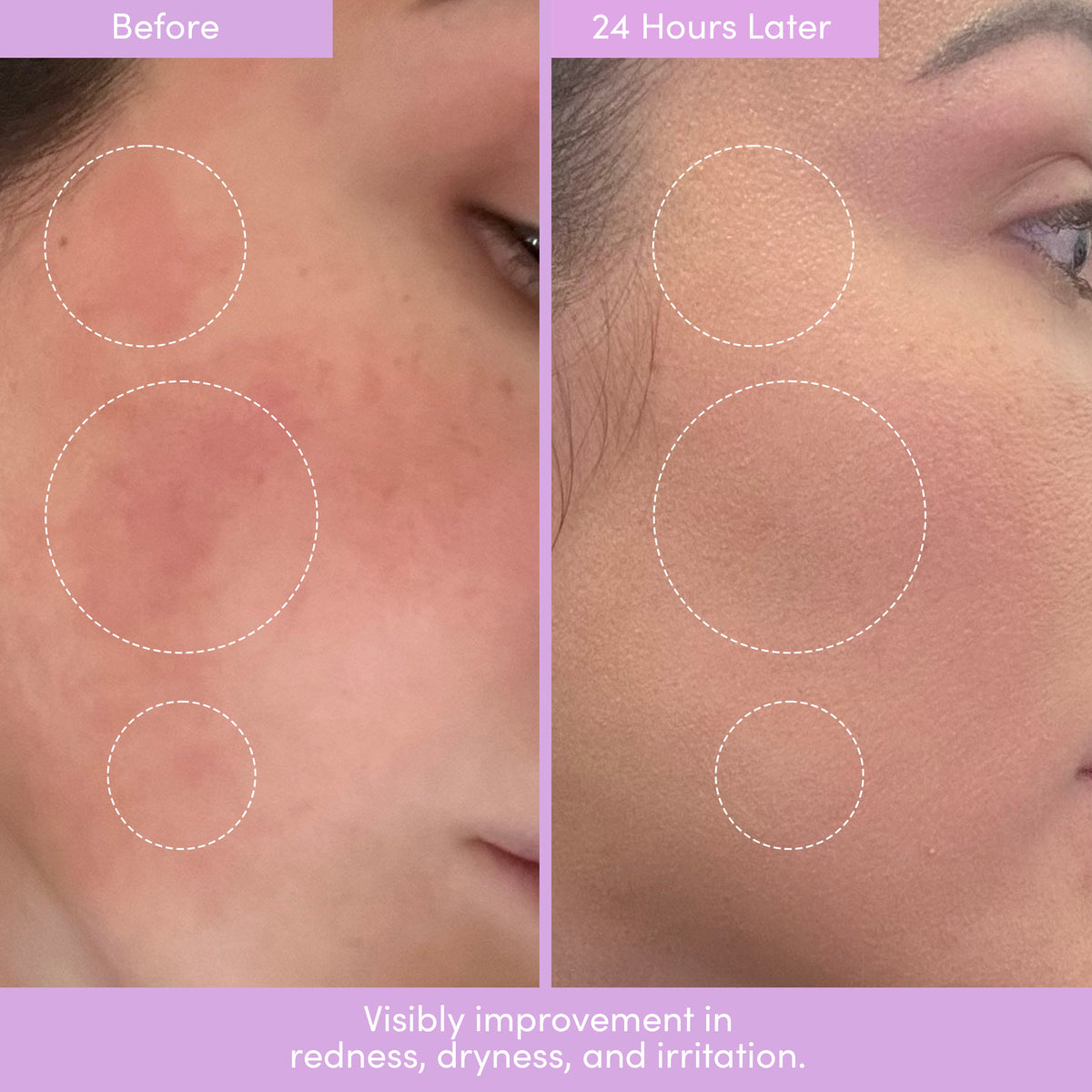 PEP TALK™ Bio-Peptide Barrier Repair Cream with Triple Lipid Complex — image 4