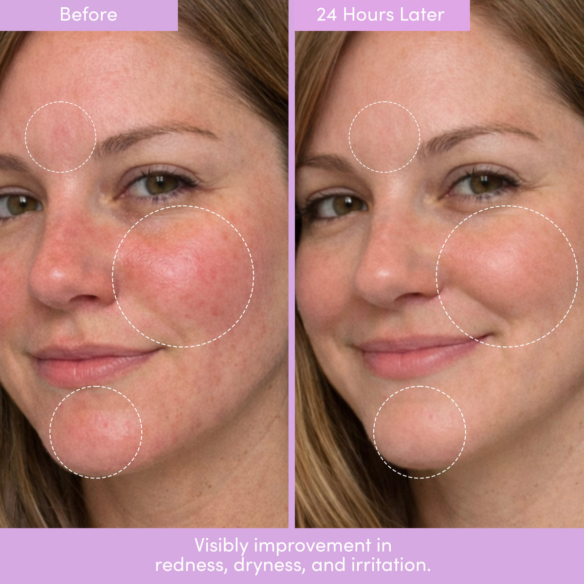 THIRST TRAP Barrier Repair Cream + SPF Ultra-Hydration Bundle — image 11