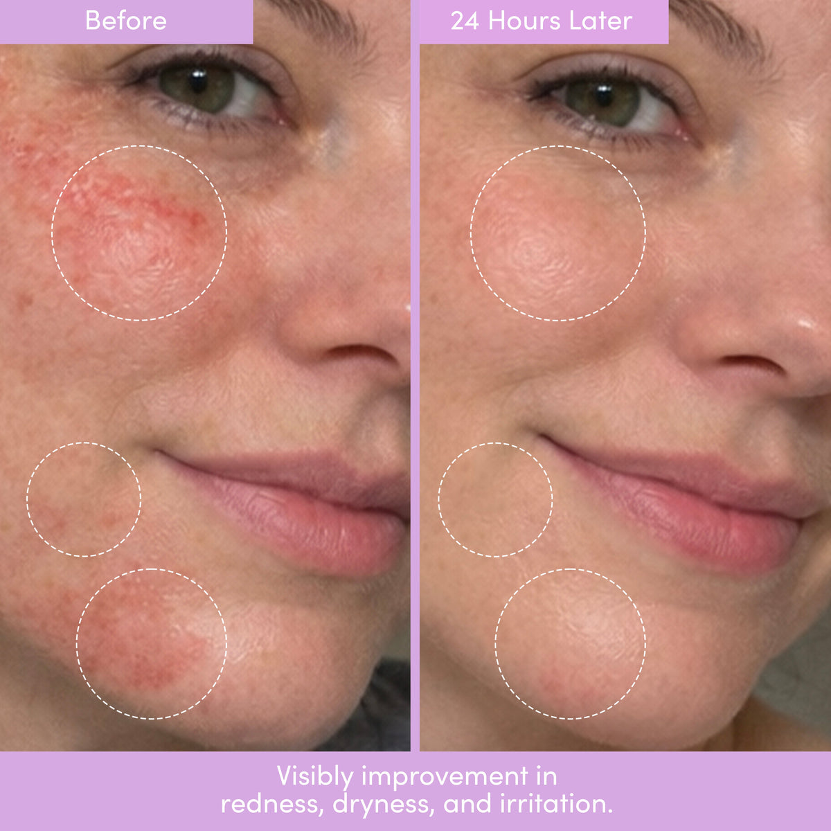THE PLACENTA FACIAL Dark Spot Serum + Barrier Repair Cream Bundle — image 12