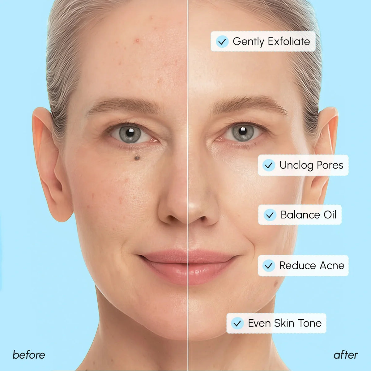 Glycolic & Salicylic Acid Peel Pads — image 5
