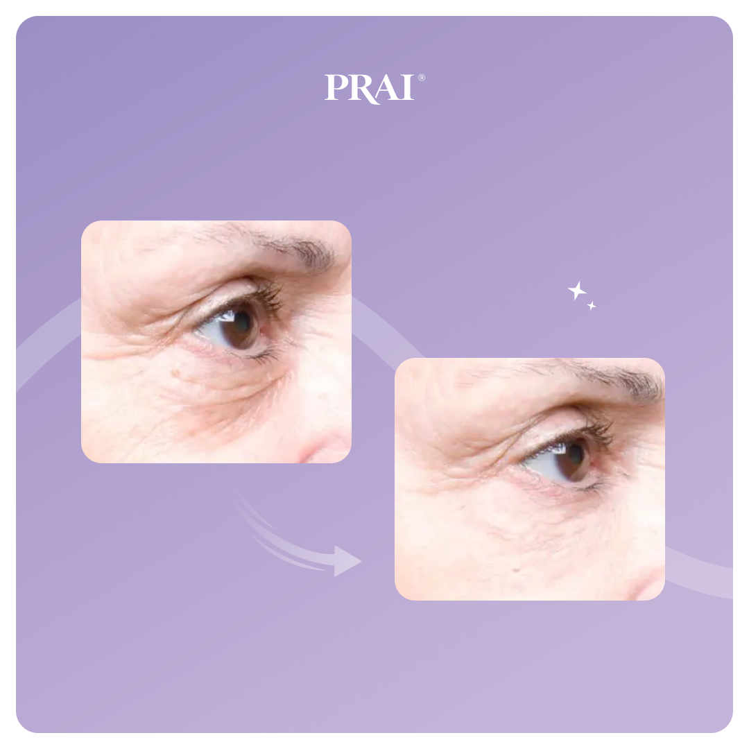 Ageless Eye Tight Uplift Serum by PRAI Beauty — image 3 of 6