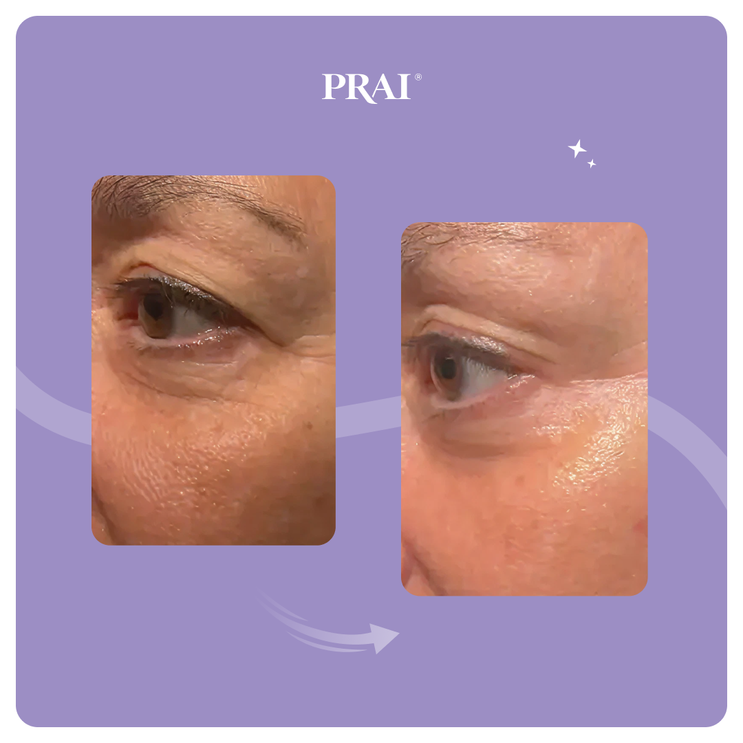 Ageless Eye Tight Uplift Serum by PRAI Beauty — image 4 of 6