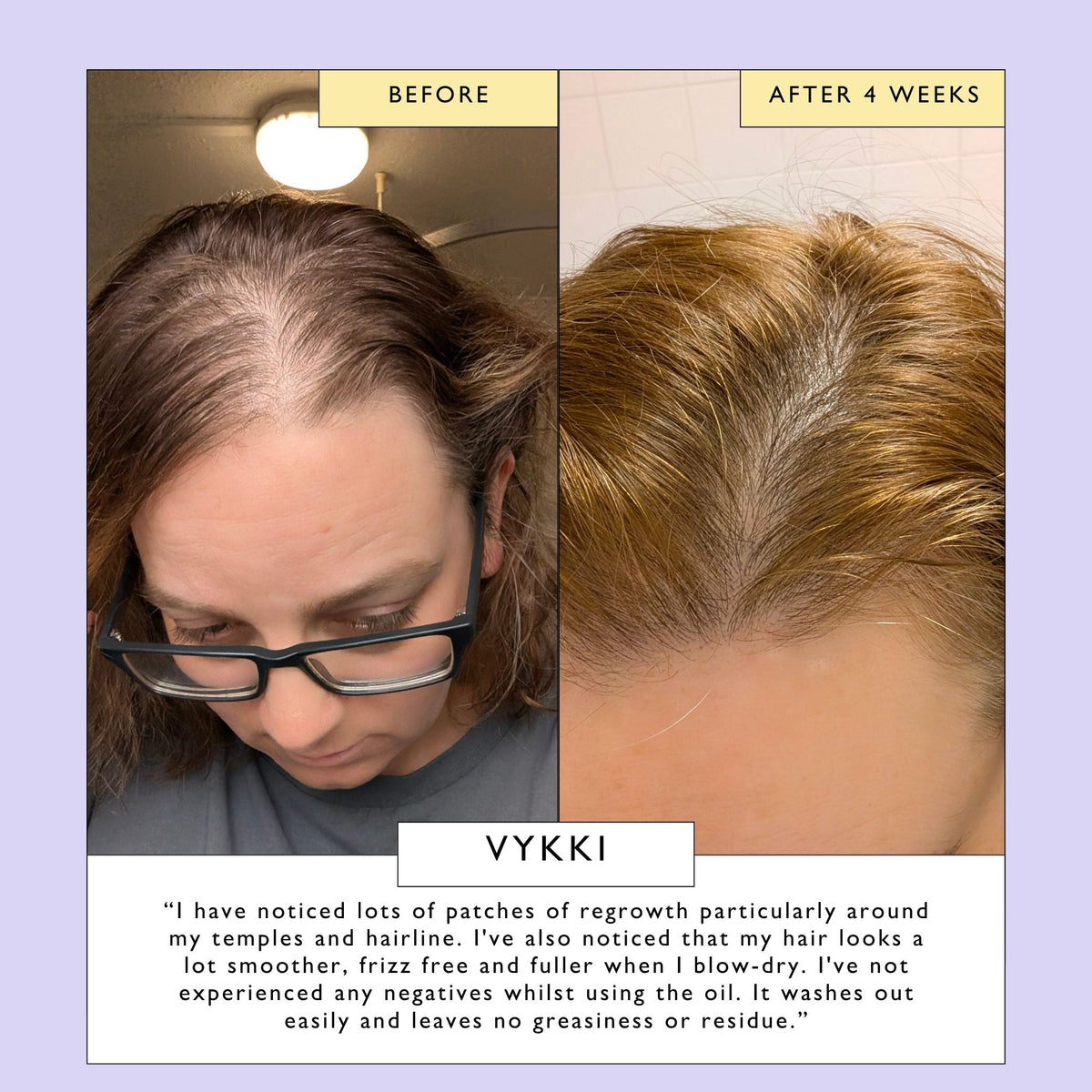 Scalp + Hair Oil with Bacuri Butter + Castor Oil — image 9