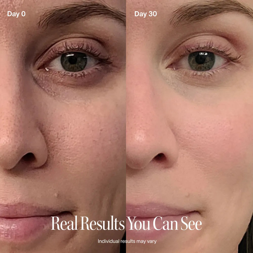 4-in-1 Red Light Therapy Wand & Activating Serum Kit — image 11