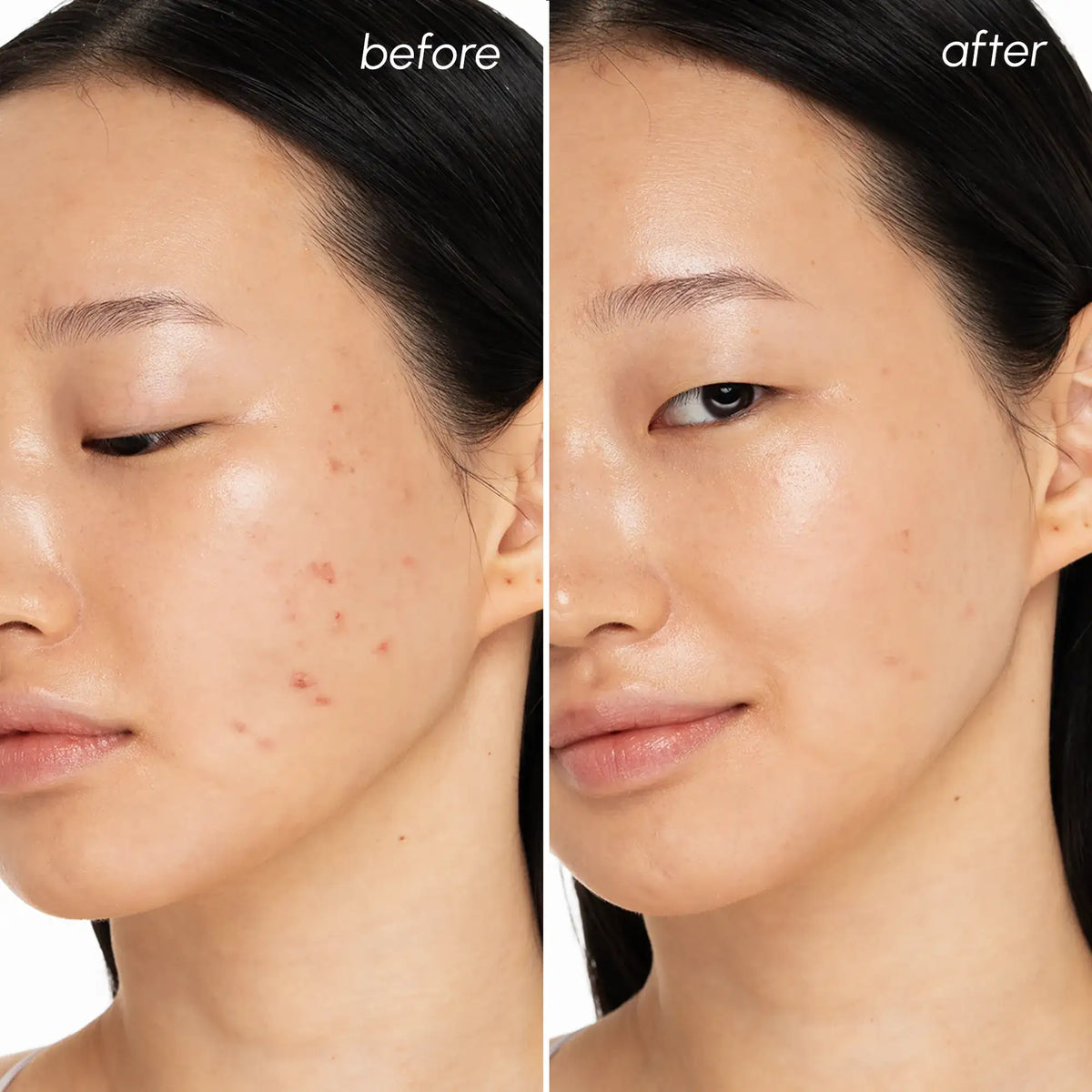 Witch Hazel Clearing Pads — image 3