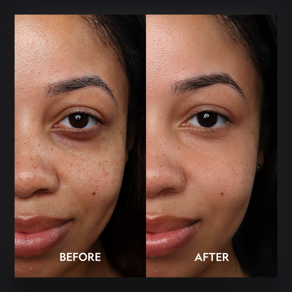 Super Bright Dark Circle Serum Peptide Corrector by YENSA — image 16 of 19